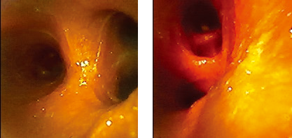 USHIO Theia-40 系列內窺鏡實際效果